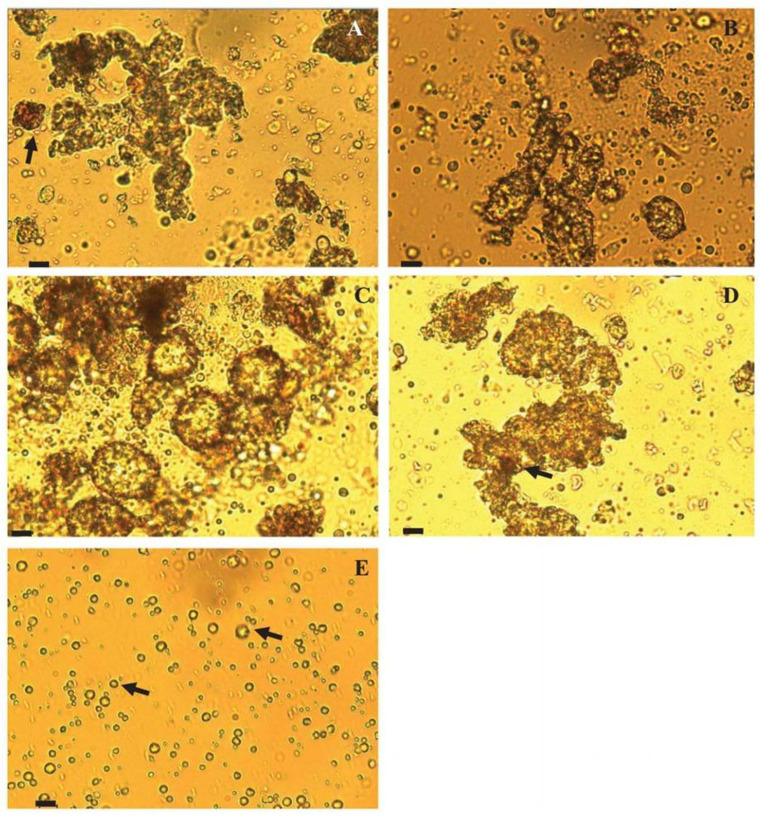 Light microscopy images showing the effect of different formulations on ganache microstructure. The diluted ganache formulations were prepared with different ratios of milk fat from cream (intact milk fat globules) and from butter (fragmented milk fat globules). The figure parts A-D depict formulations with the following weight ratios of milk fat from cream to butter: (A) 0:1, (B) 3:7, (C) 3:2, and (D) 1:0. Part (E) shows the cream diluted with water only. Scale bars represent 10 µm size at 400× magnification; arrows in parts (A) and (D) indicate cocoa powder in ganache formulations, and arrows in part (E) indicate milk fat globules in the cream. Reproduced with permission from Ref. [2]. Copyright 2018 John Wiley and Sons.