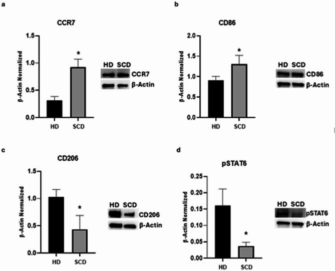 Characterization of macrophages derived from SCD pediatric/young patients. CCR7 (a), CD86 (b), CD206 (c), and pSTAT6 (d) protein expression levels in sickle cell disease (SCD) macrophages compared to those of healthy donors (HD), evaluated by Western blotting starting from 15 µg of total lysates. The most representative images are displayed. The protein bands were detected through Image Lab Ink 6.1 software “BIORAD”, and the intensity ratios of immunoblots compared to HD, taken as 1, were quantified after normalizing with the respective controls. The relative quantification for these proteins, normalized for the housekeeping protein β-Actin, is represented in the histograms as the mean ± SD. An unpaired t-test was performed for statistical analysis. *, p ≤ 0.05 compared to HD. Original blots/gels are presented in Supplementary Uncropped WB Figures.