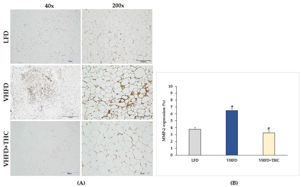 Effect of THC on MMP-2 expression in VHFD-induced obese mice:(A) Representative MMP-2 expression; left column, magnification 40×; scale bar = 500 μm; right column, magnification 200×; scale bar = 100 μm; (B) % MMP-2 expression. Data are presented as mean ± SEM. *p < 0.001 vs. LFD group; #p < 0.001 vs. VHFD group.