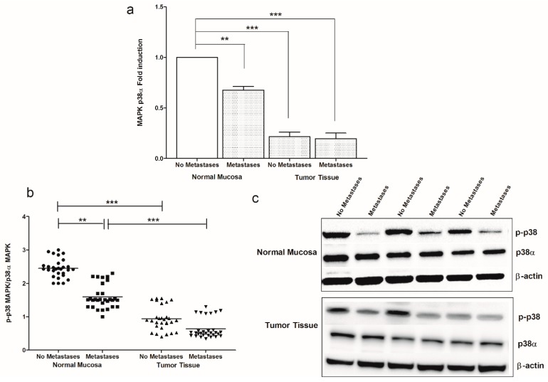 (a) MAPK p38α gene expression levels in intestinal tissue of no metastases (n = 29 patients) and with metastases patients (n = 30 patients) detected in both normal mucosa and tumor tissue. Data, expressed as mean value ± SD, are presented as fold induction, compared to normal mucosa of patients without metastases. (b) Dot plots graph of p-p38 MAPK/p38α MAPK ratio protein values detected in our patients groups. ** p < 0.02, *** p < 0.001 indicate statistically significant differences (one-way analysis of variance with Dunnett’s and Tukey’s multiple comparison test, where appropriate). (c) Representative Western blot bands of p-p38, p38α and β-actin proteins.