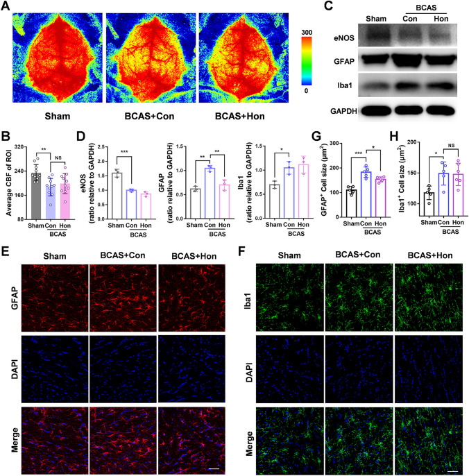 Effect of honokiol on cerebral blood flow (CBF) and activation of astrocytes and microglia after BCAS. A Representative CBF images for each group measured by laser speckle contrast imaging at 2 months after BCAS. B Average CBF of the ROI as in A. C Western blots of the expression of eNOS, GFAP, and Iba1 in the corpus callosum with GAPDH as a loading control. D Analysis of the Western blots as in C. All results are expressed as the mean ± SD. n = 3, *P <0.05, **P <0.01, ***P <0.001, NS no statistically significant difference, one-way ANOVA. E, F Immunofluorescence staining of GFAP (green) (E) and Iba1(red) (F) in the corpus callosum at 2 months after BCAS. Nuclei are stained with DAPI. Scale bar, 50 μm. G The average size (μm2) of GFAP+ cells as in E. H The average size (μm2) of Iba1+ cells as in F. All results are expressed as the mean ± SD. n = 5, *P <0.05, **P <0.01, ***P <0.001, NS no statistically significant difference, one-way ANOVA.
