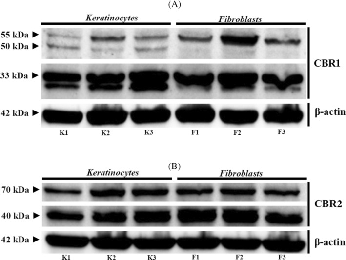 Western‐blot analysis of CBR1 (A) and CBR2 (B) expression in 3 different primary skin‐derived keratinocytes (K1‐3) and fibroblasts (F1‐3). The β‐actin was used as reference protein