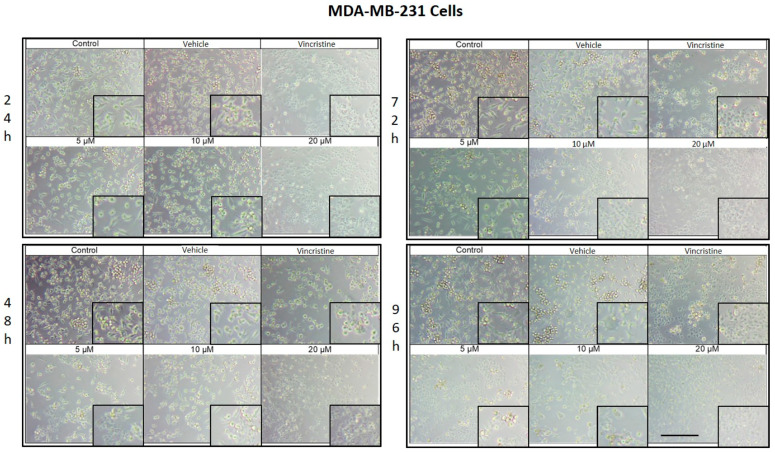 MDA-MB-231 cells treated with CBD and controls for 24 h. Treatments included CBD at concentrations of 5, 10, and 20 μM, 1 μM vincristine, methanol (vehicle), and culture medium (control). Scale bar: 300 μm.