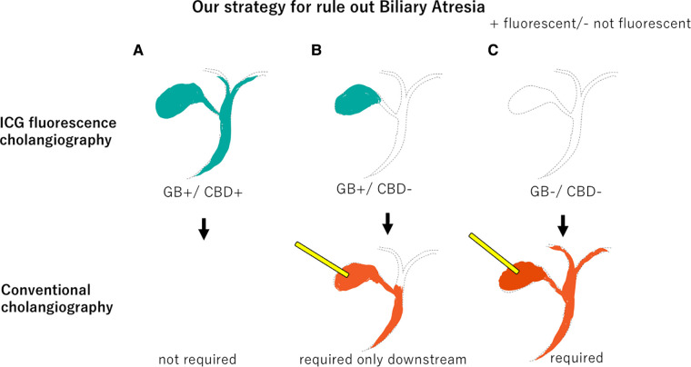 Our strategy to rule out Biliary Atresia. (A) If both the gallbladder and common bile duct fluoresce on ICG fluorescence cholangiography, conventional cholangiography is unnecessary. (B) If only the gallbladder fluoresces, only downstream should be confirmed by conventional cholangiography. (C) If neither the gallbladder nor the common bile duct fluoresces, both upstream and downstream should be confirmed by conventional cholangiography. GB, gallbladder.