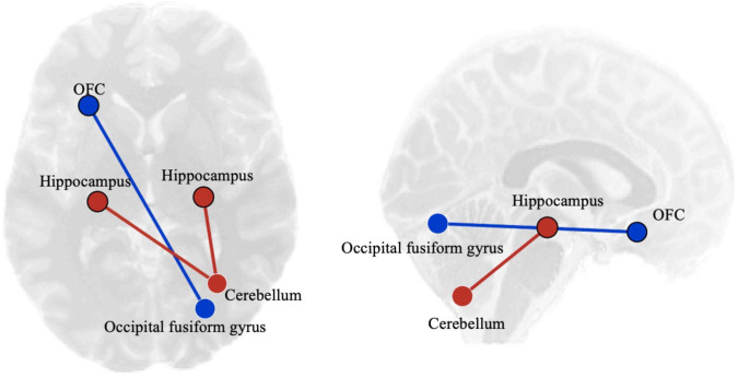 Differences between substance users and non-users showing increases (red) and decreases (blue) in resting state functional connectivity in substance users displayed from an axial view on the left and a sagittal view on the right.See Table 2 for ROI results. L, left; R, right.
