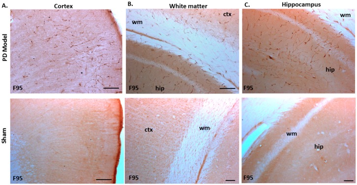 Total deiminated proteins are increased in brain tissue of pre-motor PD rats. Total deiminated protein expression was assessed by immunohistochemistry using the pan-deimination F95 antibody. (A) Increased protein deimination is observed in the brain vasculature in the cortex (ctx) of the pre-motor PD rat brains compared with that in the sham control brains. (B) Increased protein deimination is observed in white matter (wm) of the pre-motor PD rat brains compared with sham brains. (C) Increased protein deimination (F95 positive) is observed in the hippocampus (hip) of the pre-motor PD rat brains, compared with sham brains; the scale bars indicate 100 µm in all figures (ctx = cortex, hip = hippocampus, wm = white matter). (D,E) Thresholding intensity analysis of F95 positive staining showed a significant increase in the cortex (D), and the CA1 region of the hippocampus (E) of pre-motor PD models, compared with that in control sham brains (unpaired t-test, *** p < 0.001).