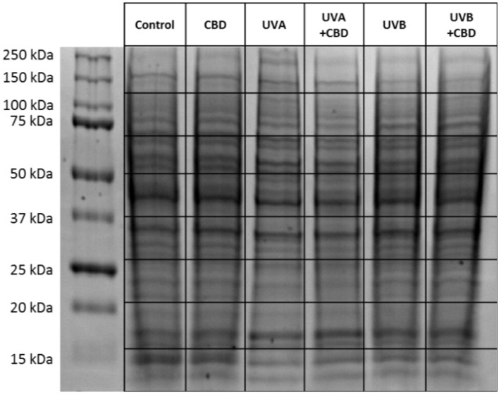 SDS–PAGE separation and staining with Coomassie brilliant blue R-250 of proteins from control keratinocytes and irradiated with UVA (30 J/cm2), UVB (60 mJ/cm2) or/and treated with cannabidiol (CBD, 4 μM) in a three-dimensional (3D) culture model. The grid indicates the borders of the protein migration zones. Original photo of the gel is added in Supplementary Figure S1.