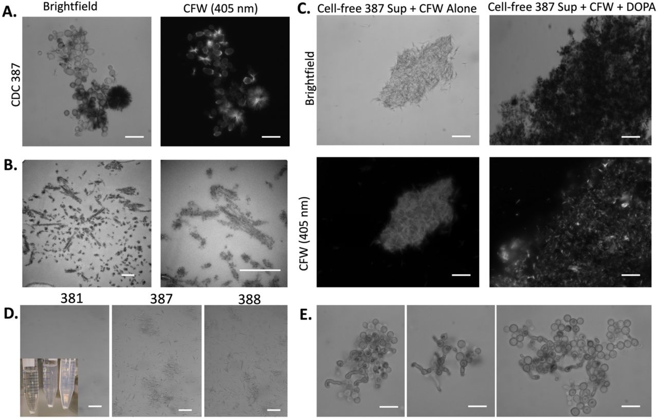 Interactions of Calcofluor White and melanin.(A) Melanizing C. auris strains (CDC 387) grown with L-DOPA and Calcofluor White (CFW) have visible crystal formation under light microscopy. These crystals are dark in color, suggesting the presence of melanin or polymerized L-DOPA, and they are fluorescent under a 405 nm wavelength laser, indicating they also contain CFW. (B) These crystals can also be seen with transmission electron microscopy. (C) Adding L-DOPA and CFW to non-melanized cell-free supernatant resulted in the formation of black crystals, which under the fluorescent microscope have signal, indicating that the crystals are a combination of both CFW and melanin/autopolymerized L-DOPA. (D) Additionally, when CFW is added to supernatant, the crystals that form in CDC 381 strain are large and settle quickly, leaving few crystals in suspension, whereas CDC 387 and 388 form smaller crystals that do not settle rapidly and remain in the suspension. Inset is an image of the falcon tube containing the supernatant with CFW, and micrographs show a sample taken from the non-settled suspension. Scale bars in A, C, D, and E represent 10 μm, and scale bars in B represent 500 nm.