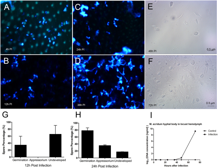 M. acridum infection stages identification to locust by natural inoculation. (A–D) Images of CFW stained M. acridum on locust epidermis over the indicated time course. Percentages of germinated spores, appressoria and undeveloped spores 12 hours pi (G) and 24 hours pi (H). Microscope observation of hyphal bodies on the hemolymph of locust on 48 hours PI (E) and 72 hours PI (F). DNA concentration of M. acridum in locust hemolymph on different infection time points (I).
