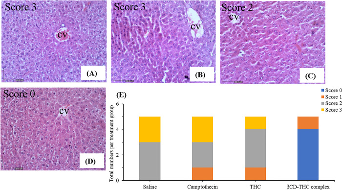 Representative photomicrographs of liver histopathology (200×).(A) liver section from control BALB/C nude mice showing metastasis injury with zone 3 necrosis around the central vein (CV). Numerous red blood cells at the inner part of the CV are seen with little lobular inflammation. (B) The liver of mice after in situ subcutaneous injection of CPT (2 mg/kg) showed congested blood sinusoids with nuclear abnormalities, such as hyperchromasia. There was also a collection of inflammatory cells with several hepatocytes that fit the morphological criteria of apoptosis. (C) THC-treated (44mg/kg) mice liver section showed cellular lesions and minimal degenerations. D) High dose treatment of 312mg/kg of βCD-THC complex on mice liver showed significant protection against drug-induced hepatic injury. E) Stack bar graph summarizing numbers of neonates with 0–3 scores based on treatment groups. Score 0- normal, 1- mild, 2- moderate, and 3- severe.