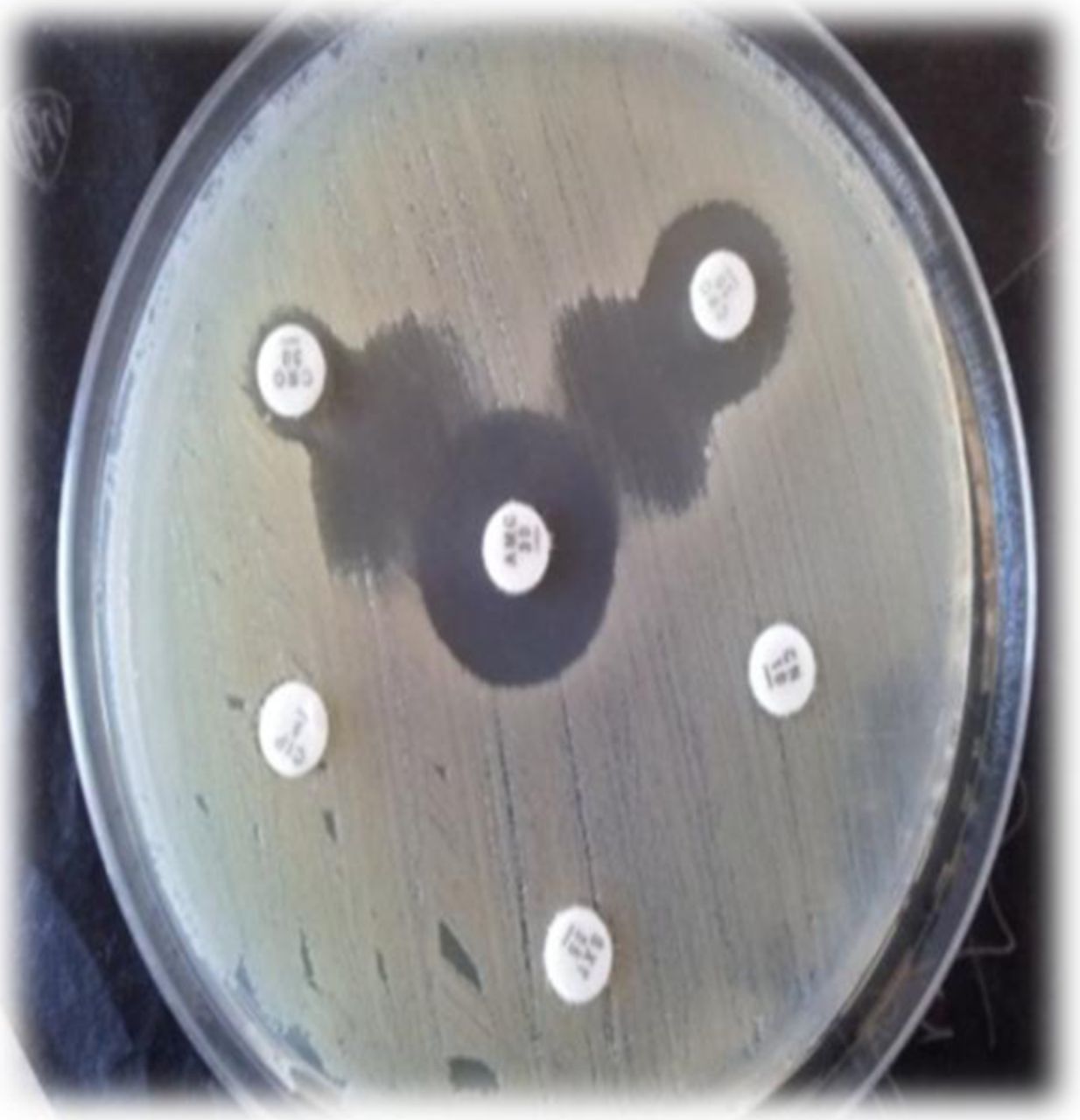 Double disc synergy test for ESBL producing organism.