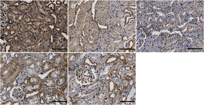 Mfn1 protein expression in rat renal tissue. Immunohistochemical labelling of Mfn1 in renal tissue in each group. a: NC; b: 4w CIH; c: 6w CIH; d: 4w CIH + Ri; e: 6w CIH + Ri. Original magnification, × 200. Scale bars, 50 μm
