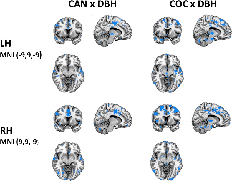 NAc related functional connectivity decrements as a function of cannabis x DBH and cocaine x DBH interactions in the left (LH) and right hemisphere (RH), (CAN = cannabis, COC = cocaine; left = left; planes are made at MNI seed position)