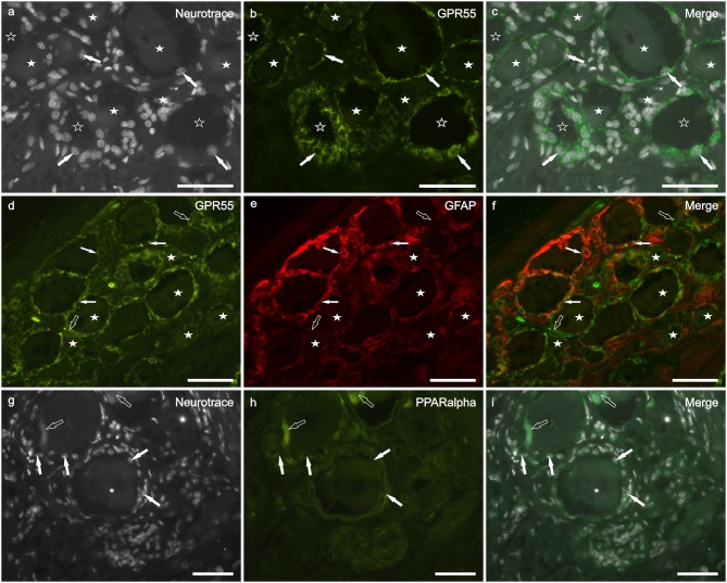 Photomicrographs of cryosections of canine cervical (C8) dorsal root ganglion showing GPR55 (a–f) and PPARalpha (g–i) immunolabeling. (a–c) Arrows indicate the Neurotrace-labeled nuclei of satellite glial cells (a) which showed bright GPR55 immunolabelling (b). White stars indicate unlabeled sensory neurons; open stars indicate empty spaces in which sensory neurons were no more evident. (d–f) White arrows indicate satellite glial cells which co-expressed bright GPR55- (d) and glial fibrillary acidic protein (GFAP) immunoreactivity; open arrows indicate SGCs which were GPR55 immunoreactive and GFAP negative (e). Stars indicate sensory neurons of different dimension, which expressed faint –to-moderate GPR55 immunoreactivity. (g–i) White arrows indicate the Neurotrace labeled nuclei of SGCs which showed PPARalpha immunoreactivity (h). Open arrow indicate autofluorescent pigment. Bar: a–i = 50 μm.