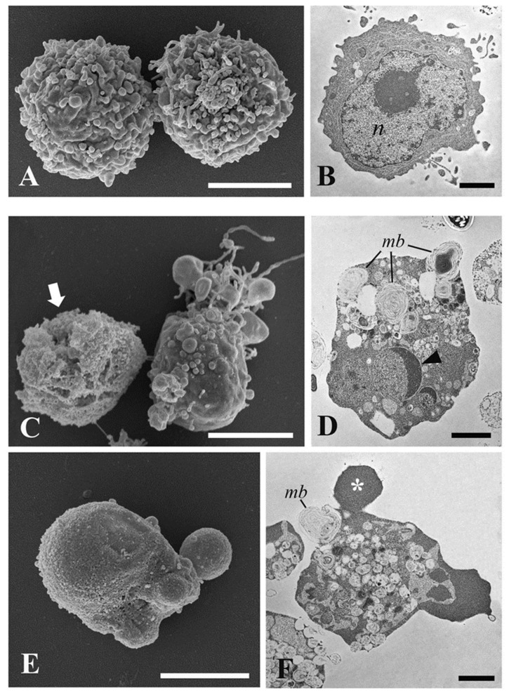 SEM and TEM investigations on HL60 cells. (A) SEM micrograph of untreated HL60 cells; (B) TEM micrograph of untreated HL60 cells; (C,E) SEM micrograph of puromycin-treated HL60 cells for 4 h; (D,F) TEM micrograph of puromycin-treated HL60 cells for 4 h. n, nucleus; mb, multilamellar bodies; arrow, dead cell; asterisk, fragmented nucleus. Bars = (A,C,E) 5 μm; (B,D,F) 2 μm.