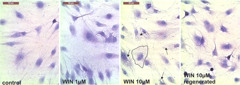 Cell morphologic changes of RA synovial fibroblasts after 48 h incubation with WIN (0 μM, 1 μM, 10 μM). Arrows indicate vacuolization; the black rimmed cell is an example of sharp edged cell bodies in contrast to unstimulated control fibroblasts. Regenerated = WIN wash-off after 48 h and supplementation with fresh medium containing 10 % FCS without WIN