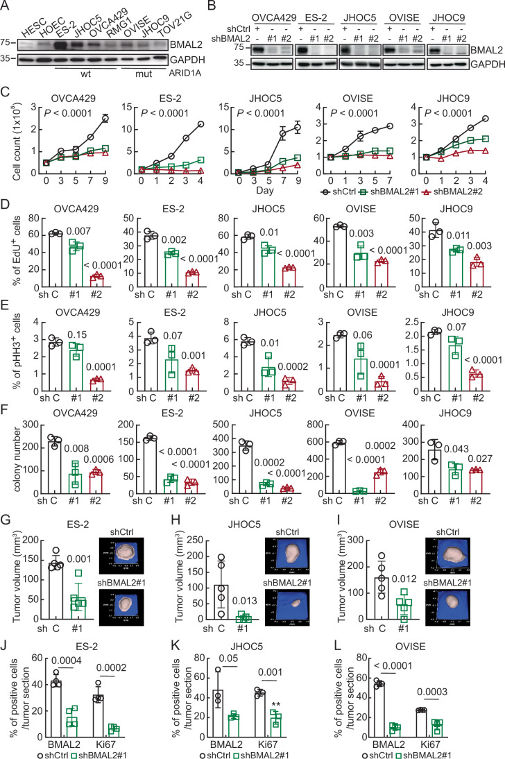 BMAL2 depletion inhibits tumorigenic ability in OCCC cells.(A) IB of BMAL2 protein expression with GAPDH as a loading control. Blots shown are from one representative experiment of three replicates. (B) IB of BMAL2 protein expression with GAPDH as a loading control in BMAL2-depleted (shBMAL2#1 or #2) OCCC cells. Blots shown are from one representative experiment of three replicates. (C) Cell growth assays using control (shCtrl) or BMAL2-depleted (shBMAL2) OCCC cells. Data were shown as mean ± SD with P value based on two-way ANOVA test (n = 3). Data shown are from one representative experiment of three replicates. (D) EdU staining assays using shCtrl or shBMAL2 OCCC cells. Data are shown as mean ± SD with P value based on unpaired t-test (n = 3). Data shown are from one representative experiment of three replicates. (E) Phospho-histone H3 (pHH3) staining assays using shCtrl or shBMAL2 OCCC cells. Data were shown as mean ± SD with P value based on unpaired t-test (n = 3). Data shown are from one representative experiment of three replicates. (F) Clonogenic assays using shCtrl or shBMAL2 OCCC cells. Data are shown as mean ± SD with P value based on unpaired t-test (n = 3). Data shown are from one representative experiment of three replicates. (G–I) Xenograft models in NUDE mice using shCtrl or shBMAL2 ES-2 (G), JHOC5 (H), and OVISE (I) cells. Five mice were used for each group. Data were means ± SD, significant difference is based on unpaired t-test of the tumor volume 3, 4, and 8 weeks after subcutaneous injection, respectively. Representative 3D ultrasound tumor images are shown here, and all individual tumor images are presented in Fig. EV1D. (J–L) Quantification and comparison of the percentage of BMAL2 and Ki67 expressing cells detected by IHC in shCtrl or shBMAL2 ES-2 (J), JHOC5 (K), and OVISE (L) derived tumors. Three to four tissue sections from each of the representative tumors shown in (G–I) were used (ES-2, n = 4; JHOC5, n = 3; OVISE, n = 4) for staining and quantification. Data were shown as mean ± SD with P value based on an unpaired t-test. Source data are available online for this figure.