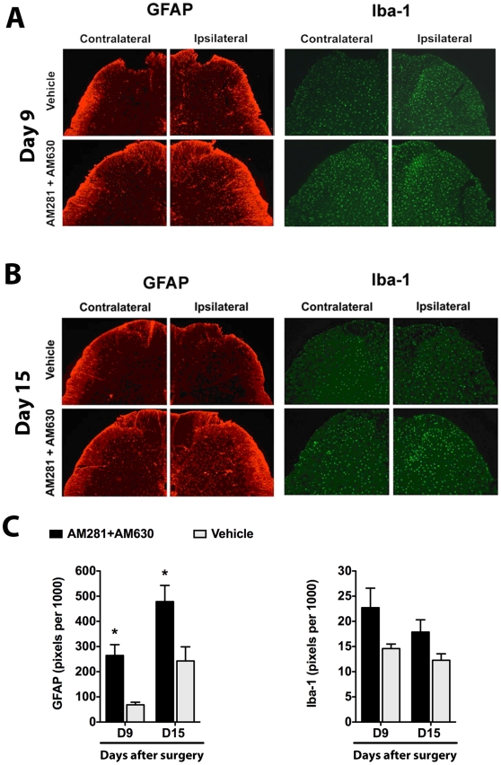 Dual blockade of CB1 and CB2 receptors results in persistent over-expression of GFAP.Representative images show GFAP (astrocytic marker) and Iba-1 (microglial marker) staining in the L5 dorsal horn ipsilateral and contralateral to paw incision in vehicle- and AM281 + AM630-treated rats at postoperative days 9 (A) and 15 (B). Quantification of these markers in laminae I-II is shown in the bottom panel (C). Staining was quantified as the number of pixels above a set threshold per total pixels in the selected area. Vehicle group: Iba-1-day 9, n = 4; Iba-1-day 15, n = 8; GFAP-day 9, n = 3; GFAP-day 15, n = 8. AM281+AM630 group: Iba-1-day 9, n = 4; Iba-1-day 15, n = 6; GFAP-day 9, n = 3; GFAP-day 15, n = 6. *p<0.05 vs. vehicle group by two-way ANOVA followed by Bonferroni post test.