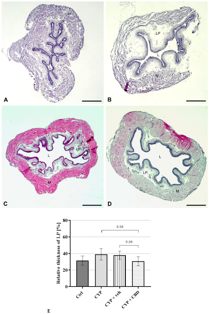 Representative micrographs taken with a stereomicroscope showing the thickness of the lamina propria in urinary bladders from all experimental groups of mice. In the bladder wall of a control mouse, the lamina propria is thin (A), while in the bladder of a CYP-treated mouse, the lamina propria is thickened due to prominent oedema (B). In the bladder of a CYP + veh-treated mouse, most of the lamina propria is swollen due to moderate oedema (C), whereas in the bladder of a CYP + CBD-treated mouse, only mild oedema is present in some areas, while in others the lamina propria is as thin as in control mice (D). L—lumen, U—urothelium, LP—lamina propria, M—muscle layer. H&E staining. Scale bars: (A–D) 1 mm. (E) Differences in measured relative areas of the lamina propria in the urinary bladders of the Ctrl (n = 3), CYP (n = 3), CYP + veh (n = 3), and CYP + CBD (n = 3) groups of mice. Data are presented as mean values and standard deviations for each experimental group.
