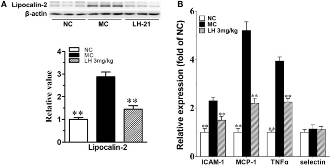 Impact of LH-21 on lipocalin-2 protein expression and gene expression of inflammatory cytokines in the aorta of KKAy mice. (A) Lipocalin-2 protein expression determined by western blot and the corresponding quantification result. (B) mRNA expression of inflammation related cytokines. Results are normalized to β-actin and expressed as relative expression compared with that in NC group. NC, normal control; MC, model control; LH, LH-21. Values are mean ± SD, n = 3; **p < 0.01 vs. MC group.