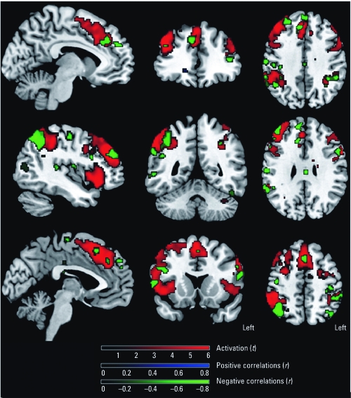 SPM maps of significant correlations (p < 0.001) between activation and lifetime solvent exposure in painters. Green indicates decreased activation with increased exposure levels (observed in anterior cingulate gyrus, prefrontal cortex, PC, and IC); blue indicates increased activation with increased exposure levels (no significant voxels present); and red indicates general group activation patterns with the N‑Back task.
