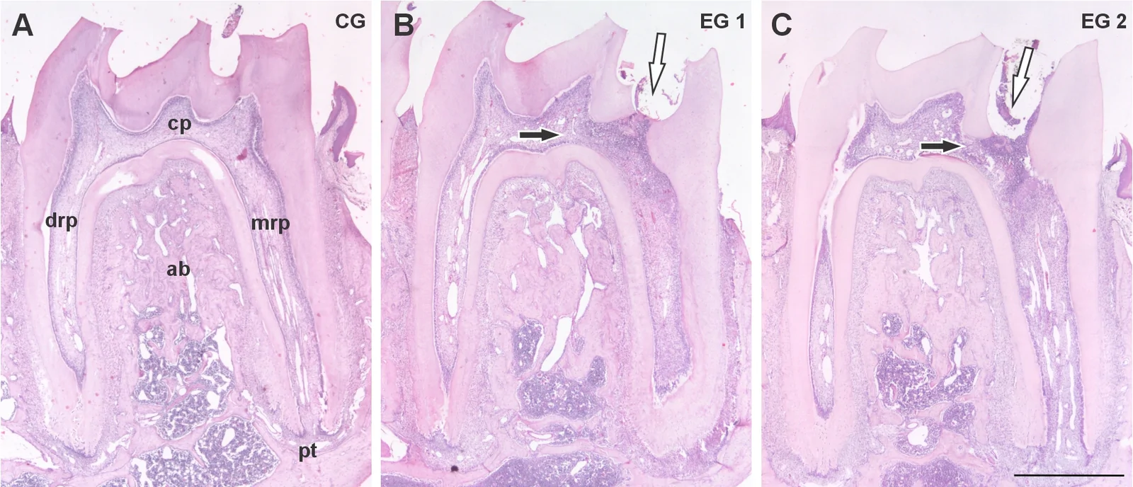 Sections showing control (A) and experimental left mandibular first molar (B and C) in the alveolar bone (ab) stained with H&E. B and C show the mesial cavity (black arrow), and the extent of the inflammatory process (white arrow) in the cameral pulp (cp). The inflammatory reactions in EG1 (B) and EG2 (C) show numerous inflammatory cells, mainly lymphocytes and macrophages. Note that the mesial root pulp (mrp), distal root pulp (drp) and the periapical tissues (pt) appeared free of morphological signs of inflammation (A – C). The scale bar represents 1000 μm.