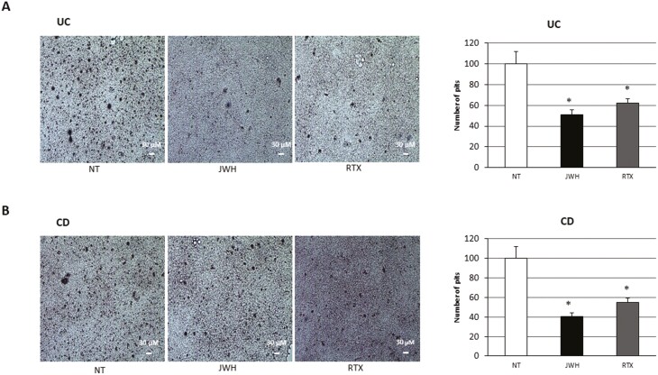 Bone resorption assays on (A) 3 patients with UC and (B) 3 patients with CD after 48 hours of exposure with JWH-133 (100 nM) and RTX (5 μM). The most representative images are displayed. The reabsorbed areas on the plate were visualized through an AE2000 inverted microscope at 10x magnification, in at least 3 different wells for each individual sample. The percentage numbers of the reabsorption pits (visualized in images as darker areas) are presented in histograms as the mean ± SD. A Student t-test was used for the statistical analysis. *P ≤ .05 compared to NT. Abbreviations: CD, Crohn’s disease; NT, untreated control; RTX, Resiniferatoxin; SD, standard deviation; UC, ulcerative colitis.