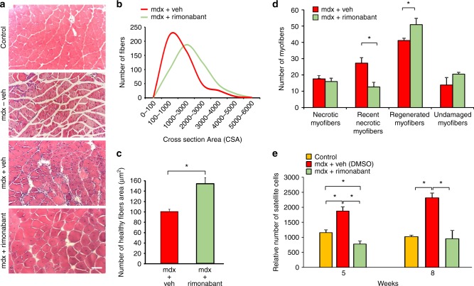 Effects of rimonabant on muscle degeneration. a Representative photomicrographs of H&E-stained transverse sections of gastrocnemius muscles isolated from wild-type (control, n = 6); mdx mice (without vehicle, n = 6); mdx mice treated with vehicle (DMSO, n = 6), or rimonabant (n = 6) 0.5 mg Kg−1 IP from week 5 to week 7 of age. Scale bars = 100 μm. b Total number of myofibers within each cross-sectional area (CSA, µm2). c number of healthy myofibers within each cross-sectional area (CSA, µm2). d Bar graph indicates the number of necrotic, partially regenerated (recently necrotic), fully regenerated and undamaged myofibers in control (DMSO) and rimonabant-treated mdx mice. Mice were treated from week 5 to week 7 of age. Each bar is the mean ± SEM. *P ≤ 0.05 vs. vehicle group, determined by Student’s t test. e Bar graph showing the relative number of satellite cells found in the gastrocnemius muscles of control and mdx mice treated with vehicle (DMSO) or rimonabant. Each bar is the mean ± SEM of four independent determinations