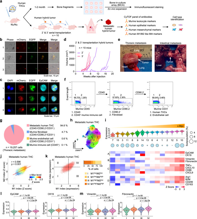 Increased c-Myc is associated with upregulated M1- and M2-like macrophage genes and epithelial-mesenchymal plasticity in metastatic human hybrid tumor.a Schematic diagram of serial transplantation of human hybrid tumor in mice. THCs in the femur and spine were enriched through bone-in-culture array (BICA). A metastatic tumor found after serial transplantation was analyzed by single-cell proteomic cytometry by time-of-flight (CyTOF). b, c Representative inverted microscope images (b, n = 5 mice) and immunofluorescence images (c, n = 2 mice) of BICA cells. A bi-nucleated cell was shown in cell #1 in panel c. Scale bar, 10 µm. d Growth curves of the secondary (purple, n = 5 mice) and tertiary (red, n = 5 mice) transplanted hybrid tumors. e A visible metastatic lesion in the thoracic cavity of one mouse transplanted with hybrid tumors and an intestinal lesion in another xenotransplanted mouse. f–m The thoracic metastatic tumor was analyzed by CyTOF. f CyTOF gating strategy to identify metastatic human THCs and host cells in the thoracic metastatic tumor. g Pie chart showing the proportions of cell types in the thoracic metastatic tumor. h UMAP plot depicting 15 subpopulations of metastatic human THCs. i Upper: the 15 subpopulations identified in (h) were aligned by increased expression levels of c-Myc. Middle: circle plot depicting the subpopulation sizes. Lower: heatmaps showing the expression of epithelial (A), mesenchymal (B), and M1- (C) and M2-like (D) macrophage markers in each subpopulation. j Scatter plot indicating the correlation of M1- and M2-like index values and the expression of c-Myc. k Four categories stratified based on the average of M1- or M2-like index values. Violin plots showing the expression of two epithelial markers (l) and two mesenchymal markers (m) in categories I, II, III, and IV. P-values were determined using a one-way ANOVA followed by Tukey test. Source data for d are provided as a Source Data file.