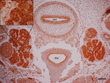 Photomicrographs of the developing thyroid (thy). Oesophagus (oes), trachea (tra) show epithelial staining. Left and right lobes of thyroid (thy) show intense cytoplasm/membrane staining of epithelial cells. Inset is an high magnification to better demonstrate subcellular localization of CB1R immunoreactivity. Scale bar is equal to 100 µm