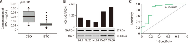 HO-1 regulation in the bile of patients with CBD stones and BTC. (A) HO-1 activity. The number of patients in each group was indicated as follows (CBD, n=13, BTC, n=57). (B) Protein level and relative expression. (C) ROC analysis of HO-1. GAPDH levels were measured to confirm equal protein loading. Patients were in two groups (n=13–57/group). All data are presented as means ± SD.