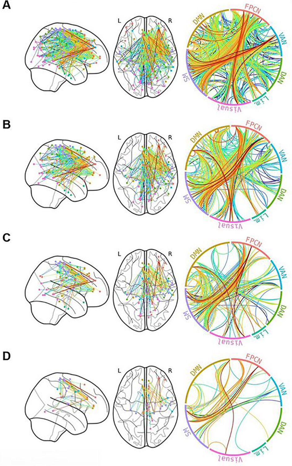 Network-based statistic subnetwork associated with past-year cannabis use among 79 adolescents at Pearson’s r thresholds of 0.3 (A), 0.325 (B), 0.35 (C), and 3.75 (D) edge color corresponds to the correlation between edge strength and past-year cannabis use. Connections appear to be primarily right-lateralized and between rather than within networks. Frontoparietal Control Network (FPCN), Ventral Attention Network (VAN), Dorsal Attention Network (DAN), Limbic Network (Lim.), Somatomotor Network (SM), Default Mode Network (DMN).