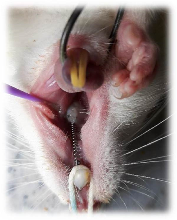 NiTi coil spring placed between the first molar and central incisor of a rat.