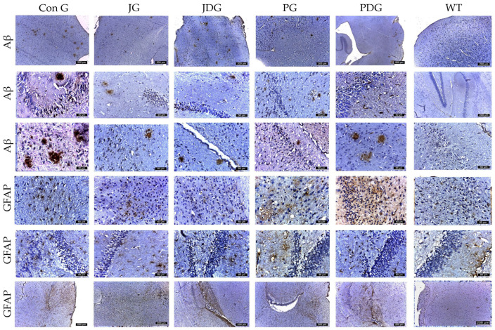 Representative immunohistochemical images of the Aβ plaques and astrocytes obtained from the control and treatment groups in both the cortex and hippocampus regions. The Aβ plaques that were identified appeared to be small, with an average size ranging from 30 to 50 µm2, except for those in the ConG group, which measured between 50 and 150 µm2. Across the different experimental groups, the average number of plaques followed a descending order as: ConG > JG > JDG > PDG > PG. GFAP-positive cells were observed in descending order as follows: PG, PDG, JG, JDG, ConG, and WT. Astrocyte numbers were assessed via GFAP staining. Notably, enlarged astrocytes were detected in the cerebral cortex, Ammon’s horn, and parahippocampal regions in the PG, PDG, JG, and JDG groups. In contrast, astrocytes in the ConG group were predominantly of medium and small sizes. Aβ: beta-amyloid; GFAP: glial fibrillary acidic protein; ConG: control group; JG: JWH-133 group; JDG: JWH-133 + donepezil group; PG: Cannabixir® Medium Flos group; PDG: EU-GMP certified Cannabixir® Medium Flos + donepezil group; WT: vehicle group.