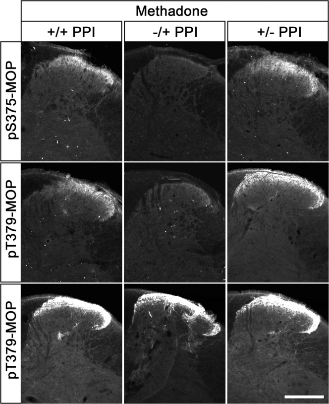 Comparison of phospho-MOP detection after staining in the presence or absence of PPIs.Animals were treated with methadone for 30 min, transcardially perfused and fixed in the presence (+) or absence (-) of PPIs and also stained in the presence (+) or absence (-) of PPIs. Shown are confocal images of coronal sections of the spinal cord stained with pS375-MOP, pT379-MOP or np-MOP antibody. Note that PPIs need to be present during the whole fixation procedures but not during the staining protocol to obtain agonist-induced phospho-MOP immunostaining. Scale bar = 250 µm.