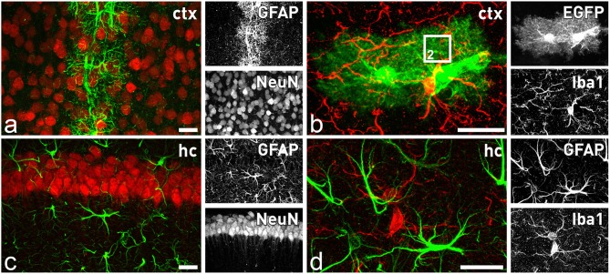 Astrocytes and microglia in the forebrain. Distinct subtypes of astrocytes are present throughout the brain, while microglial cells seem to be more homogenously distributed. In the cortex only astrocytes in close contact to blood capillaries express significant levels of GFAP (A), while all astrocytes are closely intermingled with adjacent neurons (A) or microglia (B). In contrast, in the hippocampus all astrocytes express GFAP (C). They are also in close contact to neurons (B) and microglial cells (D). Comparison of GFAP staining (D) with EGFP expression in (B) of TgN (GFAP-EGFP)GFEC transgenic mice reveals only in the latter the fine arborization of perisynaptic and perivascular astrocytic processes. The square in (B) indicates the magnified view that is schematically depicted in Figure 2. Scale bars indicate 20 μm.