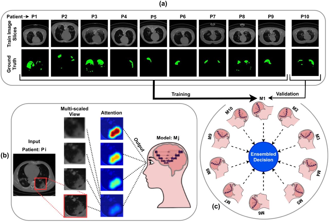 Schematic representation of Ensembling with LOPO the Attention-based Multiscaled CNNs. (a) Leave-One-Patient-Out scheme LOPO. (b) Attention-based Multiscaled view in AMC. (c) Ensembling of the AMC Models