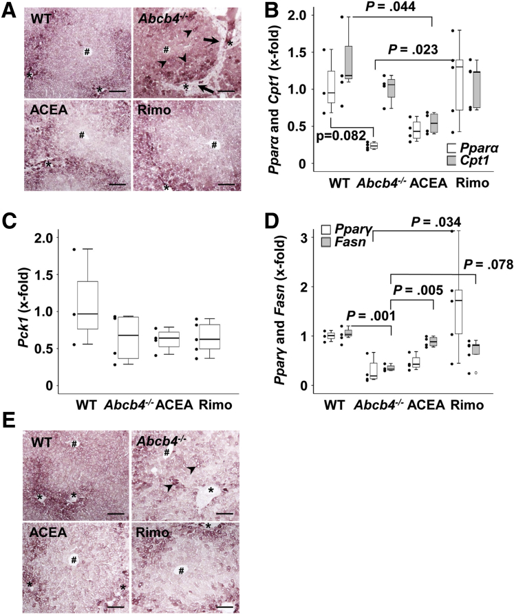 Treatment with ACEA and rimonabant ameliorated cholestatic metabolic changes in Abcb4-/-mice. (A) Immunostaining showed periportal localization of PCK1 in healthy liver (upper left panel). Zonation of PCK1 expression was disrupted in Abcb4-/- mice (upper right panel). Treatment with ACEA and rimonabant largely preserved the healthy zonation pattern of PCK1 (lower panels). Arrowheads indicate the disturbed zonal expression of PCK1 in Abcb4-/- mice. Arrows indicate periportal fibroinflammatory infiltrates without PCK1 expression. (B) Pparα was tendentially reduced in Abcb4-/- mice. Treatment with rimonabant normalized hepatic Pparα mRNA to healthy control levels. Interestingly, PPARα-regulated gene expression of Cpt1 was not altered in Abcb4-/- mice, but was reduced by treatment with ACEA. (C) Pck1 mRNA levels were constant among all groups. (D) Hepatic Pparγ transcription was tendentially reduced in Abcb4-/- mice. Rimonabant treatment increased Pparγ. Fasn mRNA was decreased significantly in cholestatic Abcb4-/- liver. Treatment with ACEA normalized Fasn, while the induction of Fasn by rimonabant was not statistically significant. (E) Immunostaining of FASN depicted the zonated expression of FASN. Similar to the disturbed distribution of PCK1 (shown in panel A), the zonation of FASN also was disrupted in cholestatic liver of Abcb4-/- mice and preserved by treatment with ACEA and rimonabant. (B–D) One-way analysis of variance and post hoc Bonferroni test were used for statistical analysis. n = 3–5 mice per group. Representative data of 1 of 3 independent experiments are shown. Original magnification: 100×. Scale bars: 100 μm. #Central vein, ∗portal tract. Rimo, rimonabant.