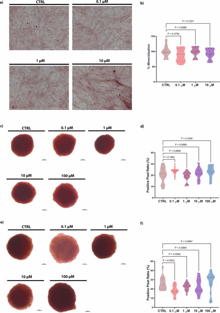 Assessment of calcium deposition on bone cells (2D and 3D models) following PFOA exposure.a Representative images of the control group and experimental groups treated with 0.1, 1, 10, 100 μM of PFOA; Scale bar = 1000 μM. Images captured using Light Lionheart FX Microscope (20×). b quantitative analysis of calcium deposition of all groups by absorbance measurement at 550 nm. Asterisks indicate the statistically significant data of the experimental groups (n = 9) compared with the control group (one-way ANOVA). c Alizarin red staining of spheroids treated with increasing concentrations of PFOA after 2 days of exposure; Scale bar = 200 μm. Images were captured using ZEISS Axio Imager A.2 (Zeiss, Oberkochen, Germany) with an Axiocam 503 camera (20×). d Quantitative analysis of the percentage of matrix mineralization in different treatment groups compared to the control group after 2 days of exposure (n = 15 individual biological replicates). e Alizarin red staining of spheroids treated with increasing concentrations of PFOA after 5 days of exposure; Scale bar = 200 μm. Images captured using ZEISS Axio Imager A.2 (Zeiss, Oberkochen, Germany) with an Axiocam 503 camera (20×). f Quantitative analysis of the percentage of ECM mineralization in different treatment groups compared to the control group after 5 days of exposure (n = 15 individual biological replicates). P values indicate the results of comparisons between each PFOA-treated group and the control group. Values of p < 0.05 are considered statistically significant.