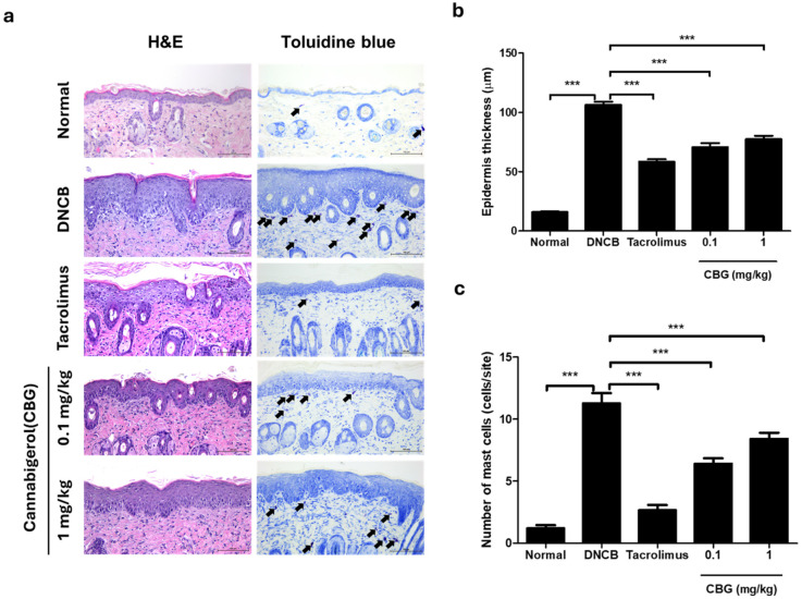 CBG reduced skin thickness and mast cell count. (a) Representative images from H&E and toluidine blue staining of dorsal skin tissues from mice after the challenge period. Histological features of dorsal skin in BALB/c mice are depicted. Mast cells (purple) in the dermis are indicated and marked with black arrows. Original magnification = ×200, scale bar = 100 μm. (b) Epidermal thickness changes for each group. (c) The number of mast cells counted and compared across each group. Data represents the mean ± SEM. Data compared among multiple groups were analyzed using one-way ANOVA. *** p < 0.001 compared to Normal or DNCB group. CBG, cannabigerol; H&E, Hematoxylin and Eosin; DNCB, 1-chloro-2,4-dinitrobenzene; SEM, standard error of the mean; ANOVA, analysis of variance.
