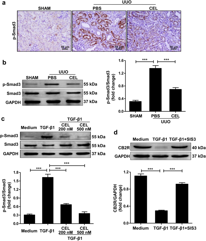 Involvement of Smad3 signaling pathway in celastrol-mediated upregulation of CB2R expression.a, b Mice received celastrol (1 mg/kg) daily for 7 days from the day of surgery. The vehicle-treated mice were treated with an equal volume of PBS. Sham group was the control for UUO mice. Kidney tissues were collected 7 days after UUO. Representative results of immunohistochemistry and western blot of p-Smad3 expression in the obstructed kidney tissue. Quantitative data were presented. c Serum-starved HK-2 cells were pretreated with or without celastrol (500 nM) for 1 h and then stimulated with TGF-β1 (10 ng/ml) for 1 h. Western blot analyses of Smad3 phosphorylation in HK-2 cells and quantitative data were presented. d Serum-starved HK-2 cells were pretreated with or without SIS3 (10 ng/ml) for 1 h and then stimulated with TGF-β1 (10 ng/ml) for 24 h. Western blot analyses of CB2R protein in HK-2 cells and quantitative data were presented. The medium group was used as the control for TGF-β1 treatment. Results are representative of three replicate experiments. All values are represented as mean ± SEM. n = 5/group. Scale bar = 50 μm. ***P < 0.001