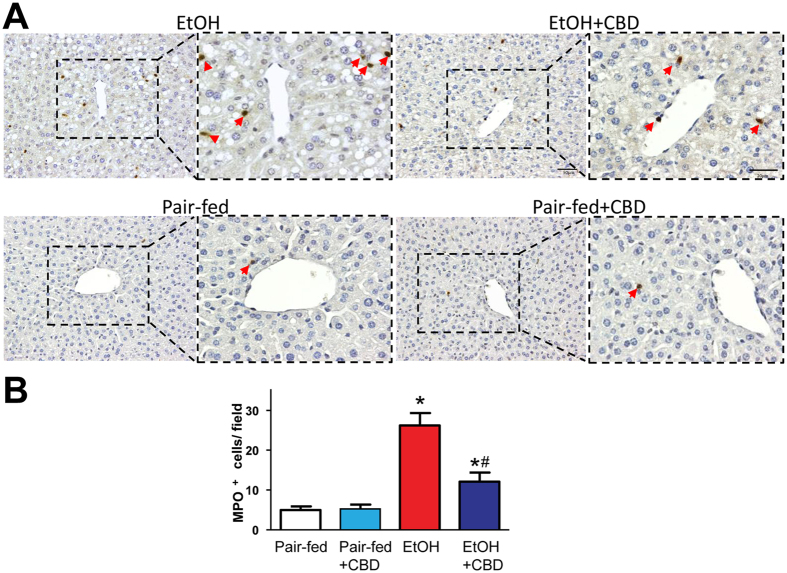 Effects of cannabidiol treatment on alcohol-induced liver neutrophil accumulation. (A) Representative liver showing myeloperoxidase (MPO) positive infiltrating neutrophils (original magnification, X200) and quantification (B). Arrows indicate MPO positive cells. Values represent means ± SEM. *P < 0.05 vs. Pair-fed group, # P < 0.05 vs. EtOH group determined by One-way ANOVA, followed by Tukey’s post-hoc test.