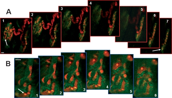Immunofluorescence localization of CB1 receptors at the neuromuscular junction (NMJ). (A) Distribution of CB1 receptors is shown in two NMJs in which the motor nerve terminal is costained with Texas red dextran. Most of the CB1 receptors (green) are seen as yellow as they overlay the nerve terminal (red). The tissue was prepared as described in Materials and methods and imaged using a Prairie confocal microscope set to collect 25 image planes at 0.5-µm intervals. Every fourth confocal image is shown proceeding from the top of the collected stack to the bottom (i.e. each image is 2 µm below or above the adjacent image). Arrows point to areas in which the CB1 receptors are observed around the periphery of presynaptic boutons. (B) CB1 receptors are shown in an NMJ in which the perisynaptic Schwann cells (PSCs) are costained with POPO®-3. The relative lack of overlap between the CB1 receptors (green) and PSCs (red) suggests that PSCs express fewer CB1 receptors than does the nerve. The tissue was prepared as described in Materials and methods and imaged using a Prairie confocal microscope set to collect six image planes at 0.5-µm intervals. The confocal images shown proceed from top to bottom. The arrow points to a PSC that appears to express CB1 receptor. Scale bars, 10 µm.