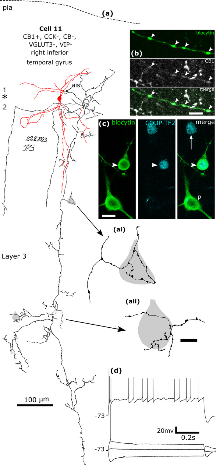 A CB1/COUP‐TF2‐immunopositive basket cell that was negative for CCK, CB, VGLUT3 and VIP, recorded and labelled by biocytin at the border of layers 1 and 2 (asterisk). (a). Reconstruction of the recovered parts of the cell (cell 11 in Figure 8f) with soma and dendrites (red) and a descending axon originating from a dendrite (ais). The axon arborised extensively in lower layer 3 and formed clusters of boutons around select cell bodies (e.g. ai and aii). Asterisk, border of layers 1 and 2. (b) The axonal boutons (arrowheads, green) were weakly CB1‐positive. (c) The nucleus of the biocytin‐labelled neuron (arrowhead) was COUP‐TF2‐positive, as was another neuronal nucleus nearby (arrow), but the nucleus of a biocytin‐labelled pyramidal cell was immunonegative (P, bottom). (d) Voltage responses of the cell to current injections of holding current +20 pA, rheobase, RB + 100 pA (upper trace), and holding current −100 pA; a voltage sag is apparent to the hyperpolarising current injection. The cell fired with an initial burst followed by irregular firing with spike amplitude accommodation when continuously depolarised. Maximum intensity projections of optical slices, Z‐stack total depth: (b), 2.9 μm; (c), 1.0 μm; Scale bars: (ai, aii) 5 μm; (b, c), 10 μm.