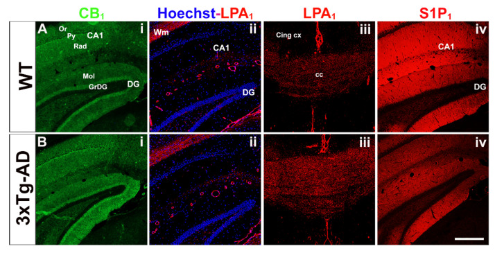 Immunolabeling of CB1 (i, green), LPA1 (ii and iii, red), S1P1 (iv, red) receptors in the hippocampus (i, ii and iv) and corpus callosum (iii) from WT (A) and 3xTg-AD mice (B). Note that CB1 and S1P1 receptors are distributed in the gray matter, whereas LPA1 receptors are mainly expressed in white matter regions. The different hippocampal subfields exhibit specific immunostaining patterns. CA1; CA1 region of hippocampus, DG; dentate gyrus of hippocampus, Or; oriens layer of CA1, Py; pyramidal layer of CA1, Rad; radiatum layer of CA1, Mol; molecular layer of DG, GrDG; granular layer of DG, Wm; white matter, cc; corpus callosum, Cing cx; cingular cortex. Scale bar = 200 µm.