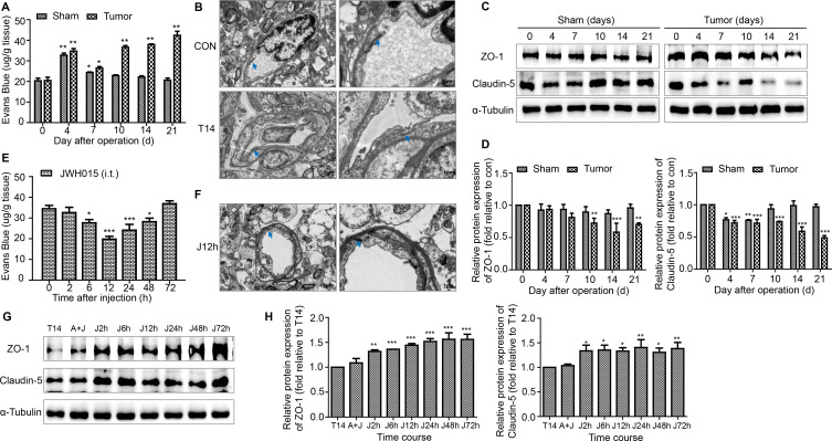 Disruption of the BSCB in BCP mice. (A) The EB leakage in the lumbar enlargement of spinal cord were tested on days 0, 4, 7, 10, 14 and 21 after operation in the sham and tumor groups. n=3 for each time point per group. (B) Representative images of the ultrastructure of the BSCB in the lumbar enlargement obtained using transmission electron microscopy on day 0 and day 14 in tumor group. Scale bar, 5 µm and 1 µm. n=3 per group. (C, D) Representative blots and quantification of TJ proteins ZO-1 and claudin-5 in the spinal cord on postoperative days in the sham and tumor groups. n=3 for each time point per group. *P<0.05 vs day 0, **p<0.01, ***p<0.001. Treatment of JWH015 improved the disruption of BSCB in BCP mice. (E) The EB leakage in the lumbar enlargement of spinal cord were tested before the injection (0 hour) and at 2, 6, 12, 24, 48 and 72 hours after the injection of JWH015 in the tumor group. n=3 for each time point per group. (F) Representative images of the ultrastructure of the BSCB in the lumbar spinal cord, which was taken from 12 hours after the injection of JWH015, obtained using transmission electron microscopy. Scale bar, 5 µm and 1 µm. n=3. (G, H) Representative blots and quantification of ZO-1 and claudin-5 at 2, 6, 12, 24, 48, and 72 hours after the injection of JWH015 compared with vehicle injection, respectively. n=3 for each time point per group. *P<0.05 vs vehicle injection, **p<0.01, ***p<0.001. All data are presented as the means±SD. Arrows showed TJ structures between the endothelial cells. BCP, bone cancer pain; BSCB, blood–spinal cord barrier; TJ, tight junctions.