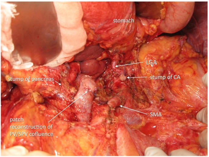 Fig. 4