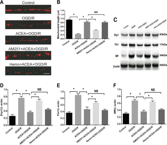 The CB1 receptor antagonist AM251 reversed the ACEA-induced effects on mitochondrial fission and the expression of fission-associated proteins.A Representative images of neuronal dendrites expressing Mito-DsRed, a mitochondrial marker. B Statistical results of the images in (A). C Western blot results showing the ACEA-induced effects on Drp1, Fis1, and Mff expressions. D AM251 reversed the ACEA-induced downregulation of Drp1 expression in OGD/R-induced HT22 cells. E AM251 reversed the ACEA-induced downregulation of Fis1 expression. F AM251 reversed the ACEA-induced downregulation of Mff expression. Bar = 1 µm; *p < 0.05; NS no significance.