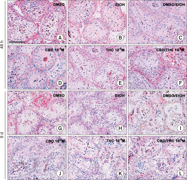CBD and THC, alone or in a mixture, do not affect the morphology of human adult testis explants. H&E staining of the histological sections of human adult testis explants cultured for 48 hours (A-F) or 9 days (G-L) in the presence of (A, G) DMSO (control CBD), (B, H) EtOH (control THC), (C, I) DMSO/EtOH (control CBD/THC), (D, J) CBD, (E, K) THC, or (F, L) CBD/THC (1:1 ratio). Pictures showed are representative of all tested cannabinoid concentrations performed on 6 donors for the short-term culture and 5 donors for the longer-term culture. Bar=100 µm. CBD: cannabidiol, DMSO: dimethylsulfoxide, EtOH: ethanol, THC: Δ9-tetrahydrocannabinol.