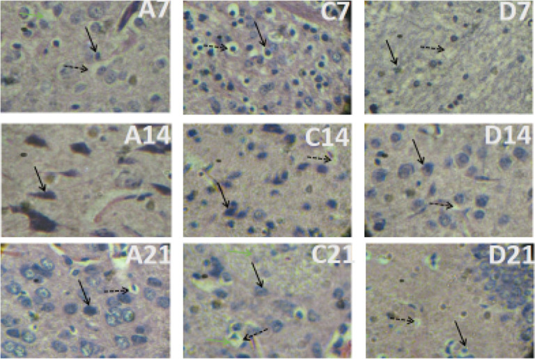 A photomicrograph of a section of the LGN of Groups A, C, and D on Days 7, 14, and 21, H&E x400Observe that neurons in the treatment groups C and D have a large, rounded nucleus (arrows) compared with group A (control) Also, observe large vacuolations (dashed arrows) within the cytoplasm in the treatment groups compared with the controls.